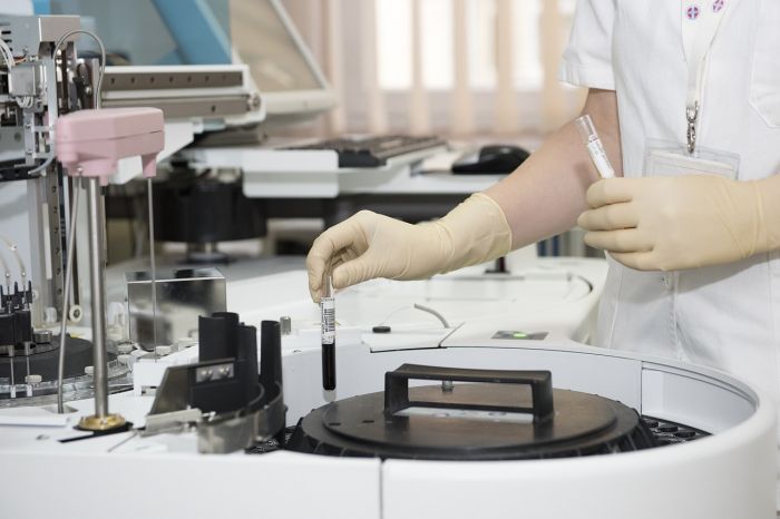 Morbillo, nuova variante identificata in Italia, può sfuggire ai test 