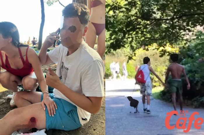 Barcola, aggredito da un pitbull mentre mangia un gelato: “Mi ha azzannato alla gamba” (VIDEO)