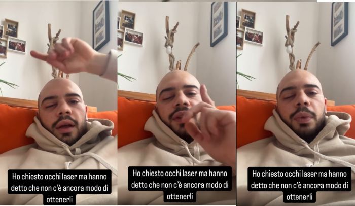 Luca Chiancone dopo l'operazione: “L’occhio migliora, ma dovrò operare anche il destro” (VIDEO)
