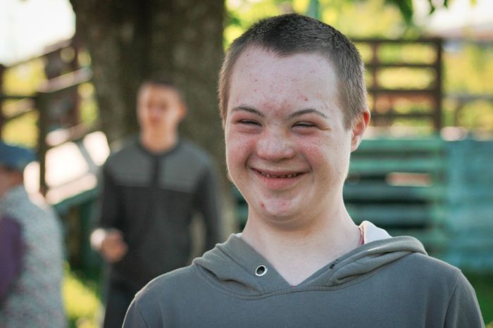 Salute: in Italia uno su 1000 nasce con sindrome di Down 