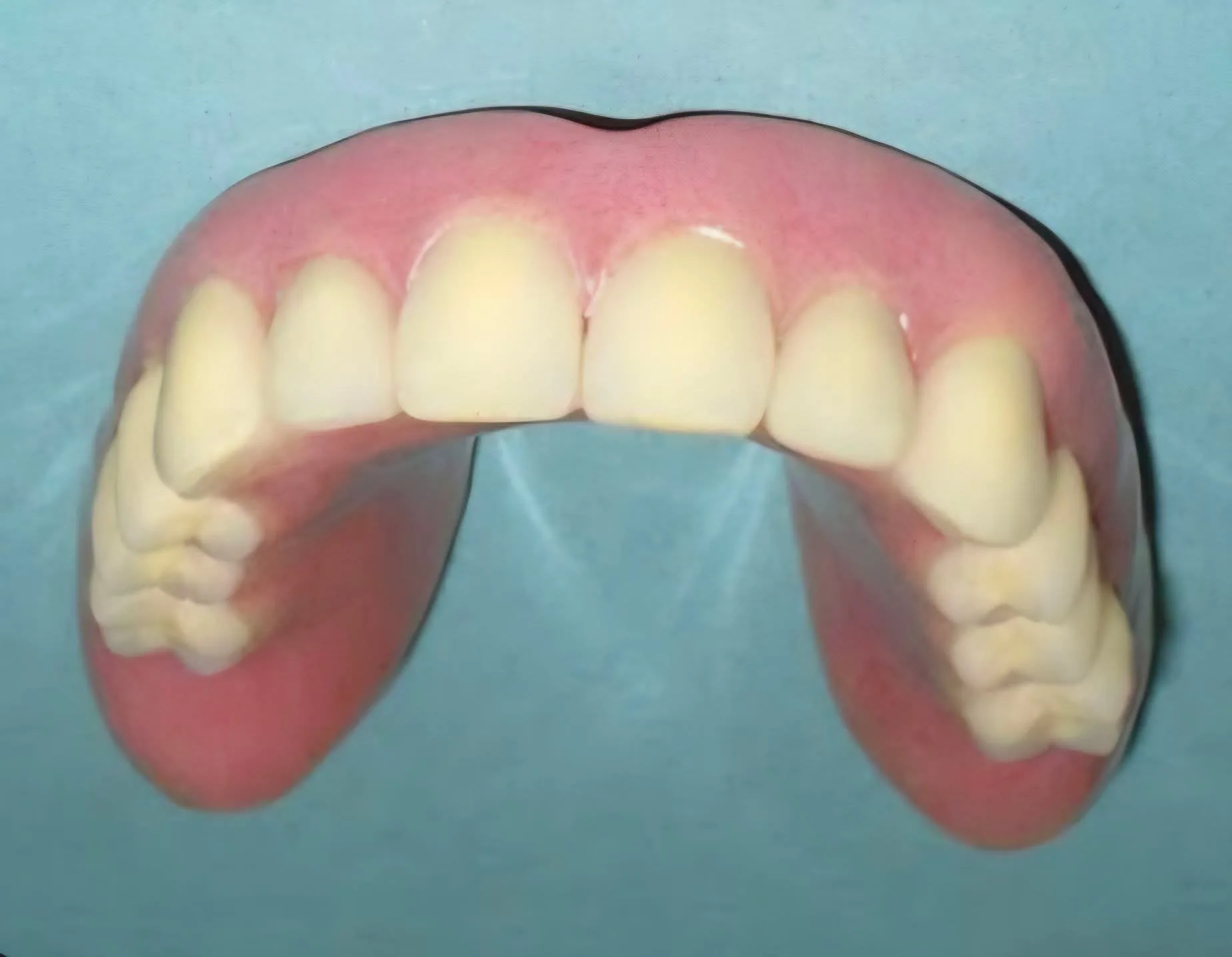 Trieste, appello per ritrovare una dentiera smarrita: «Aiutiamo un signore anziano a recuperarla»