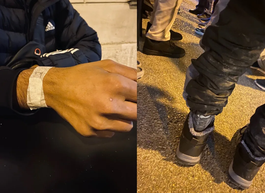 Piazza Libertà, Lorena Fornasir (Linea d'ombra) : «Arrivano di notte, bagnati e feriti. Li aiutiamo»